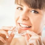 Clinica Dental Flora Rabotnicoff - Sant Feliu de Guíxols - Blog - Ortodoncia invisible